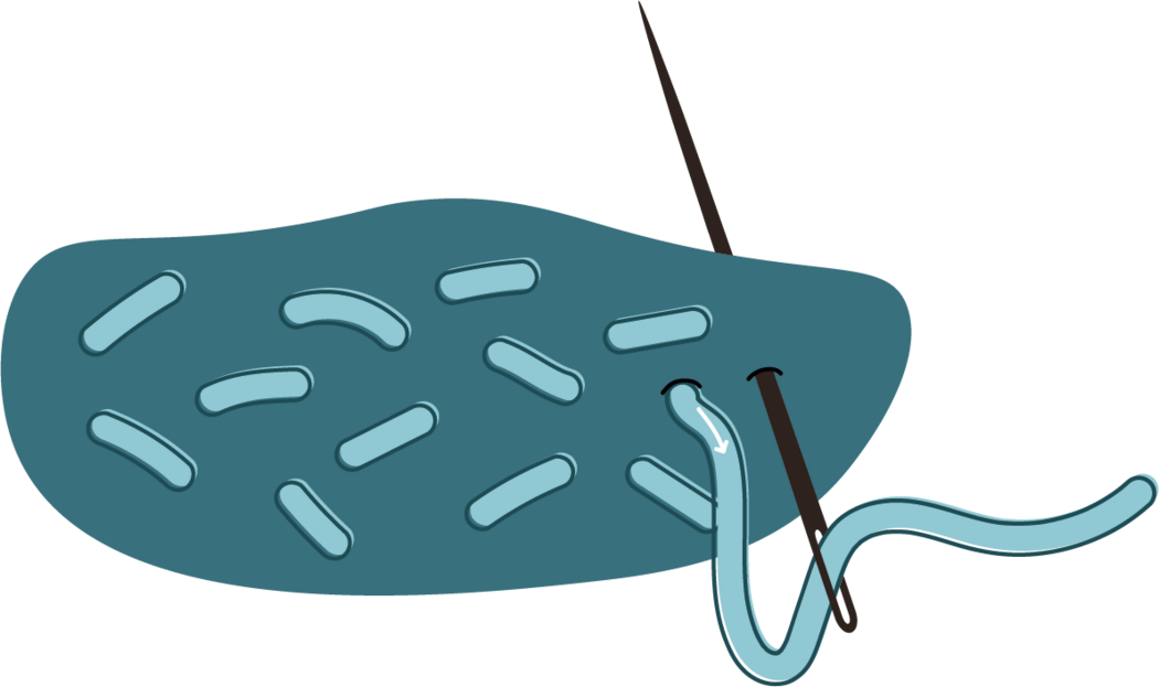 Seed stitch